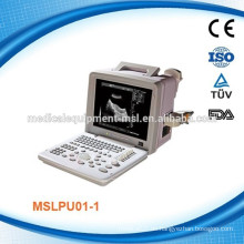 Tragbares Diagnostik-Ultraschallsystem MSLPU01P